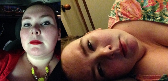 Glitterdome before and after: on the left, a selfie of me in a car, looking made-up and wearing a necklace with neon skulls on it, on the right, a picture of me lying down in bed with no makeup and a weary expression.